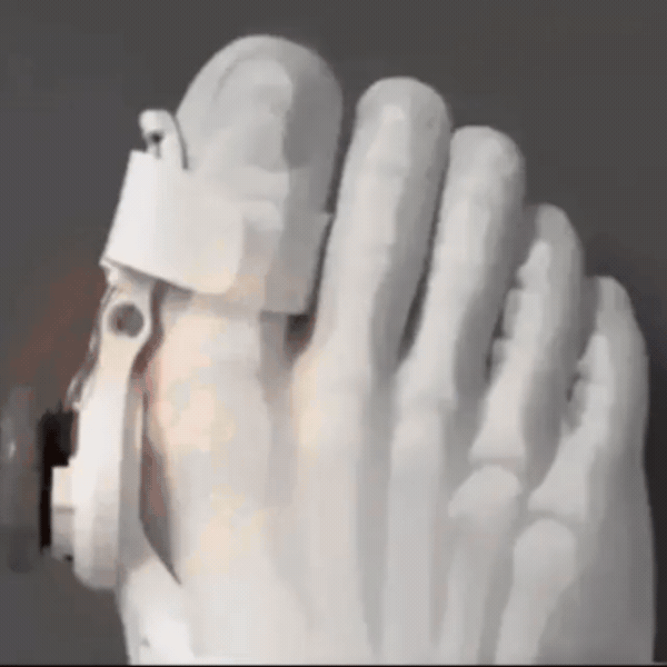 HalluxFlex – Valgus Korrektor